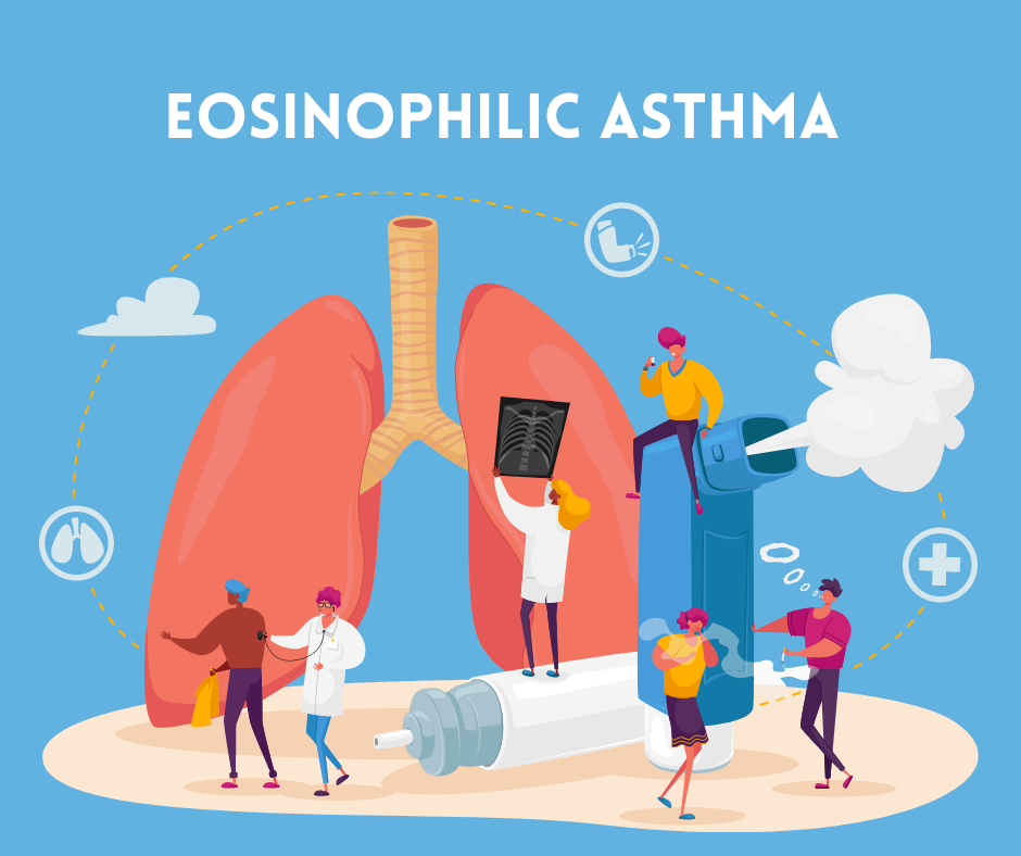 What is Eosinophilic Asthma?